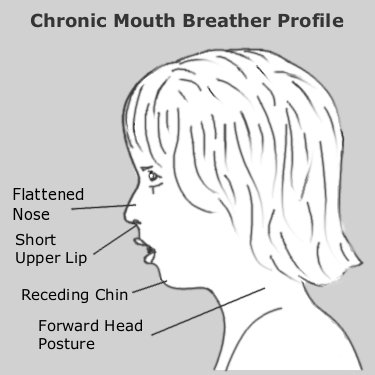 mouth breathing